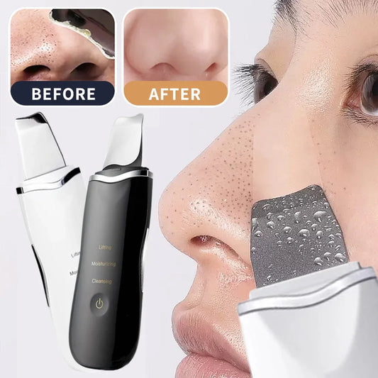Ultrasonic Skin Scrubber Spatula Peeling Blackhead Remover Deep Face Cleaning Lift Machine Peeling Shovel Pore Cleane