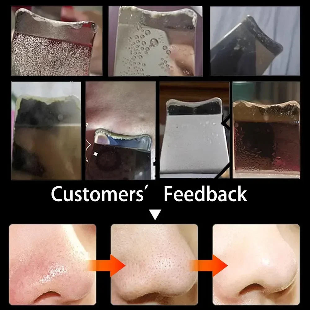 Ultrasonic Skin Scrubber Spatula Peeling Blackhead Remover Deep Face Cleaning Lift Machine Peeling Shovel Pore Cleane