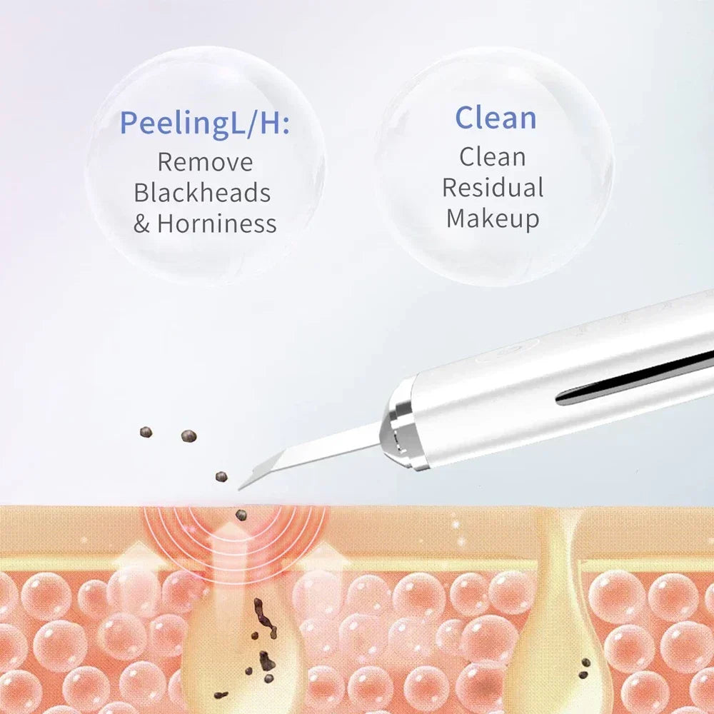 Ultrasonic Skin Scrubber Spatula Peeling Blackhead Remover Deep Face Cleaning Lift Machine Peeling Shovel Pore Cleane